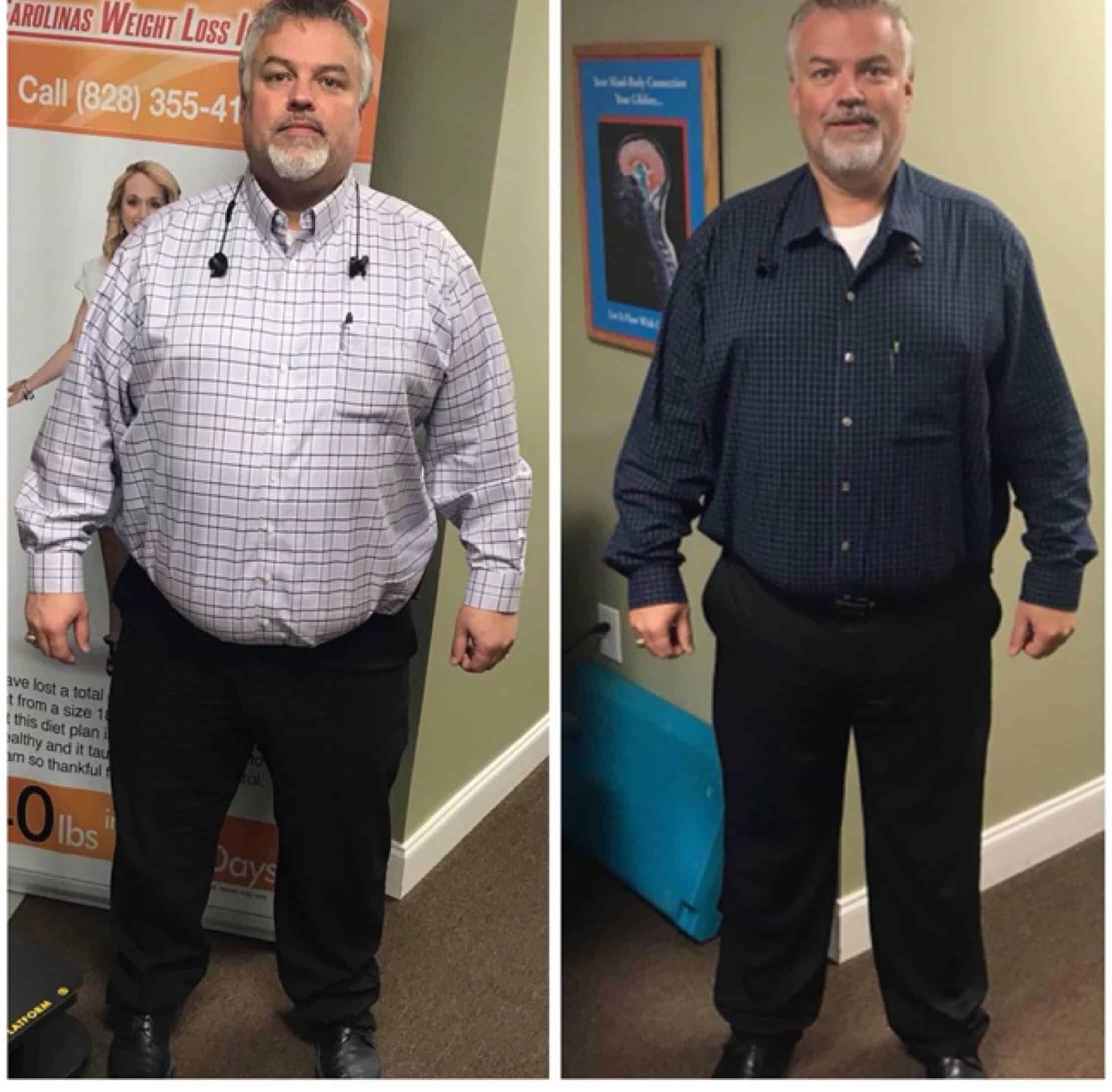 Alton, Lost 63 lbs