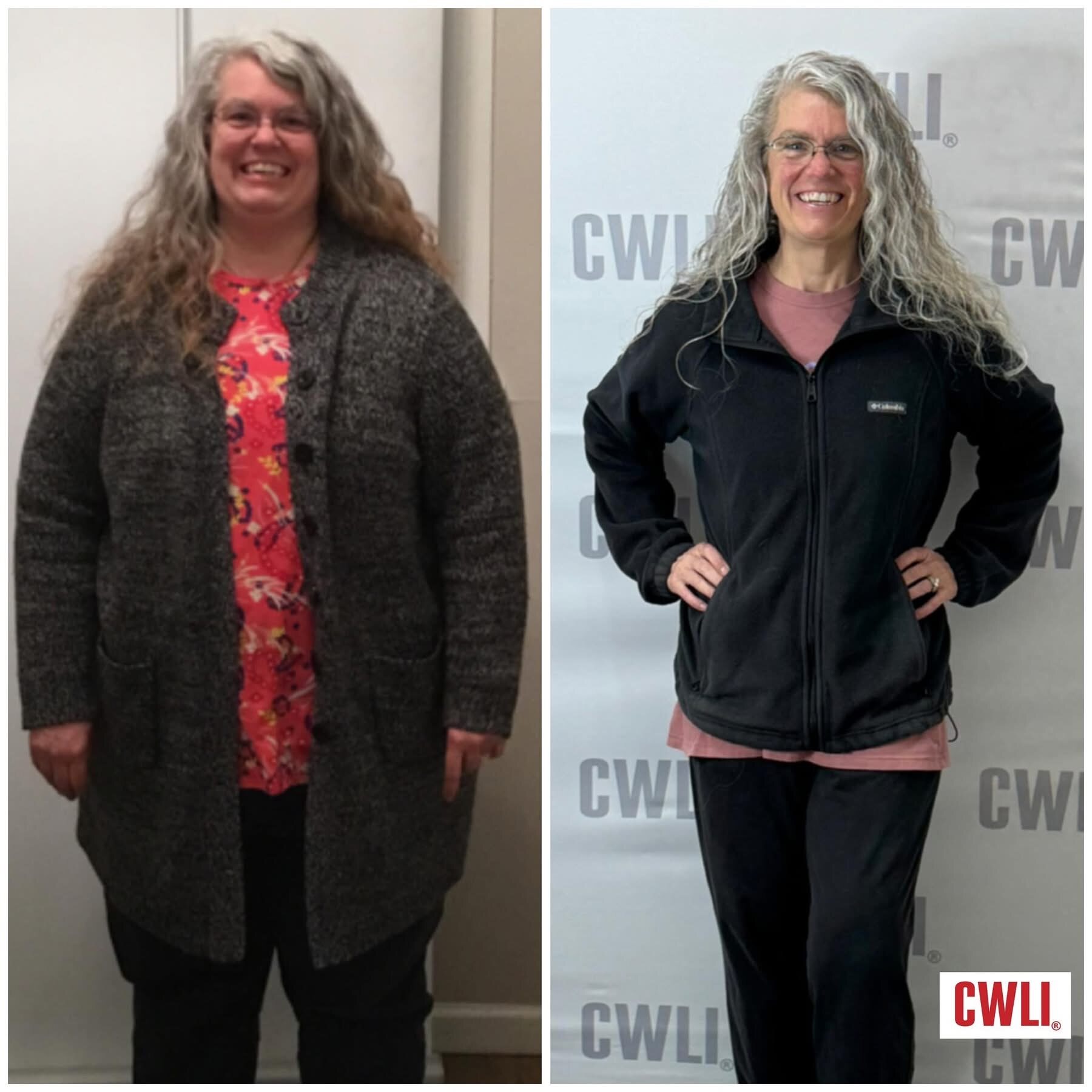 Sandra P., Lost 146 lbs